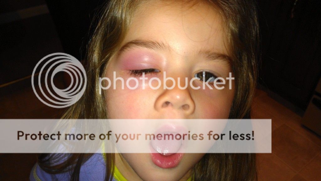 Here Is A Pic Her Eye Was Open Here Is A Pic Her Eye Was Open